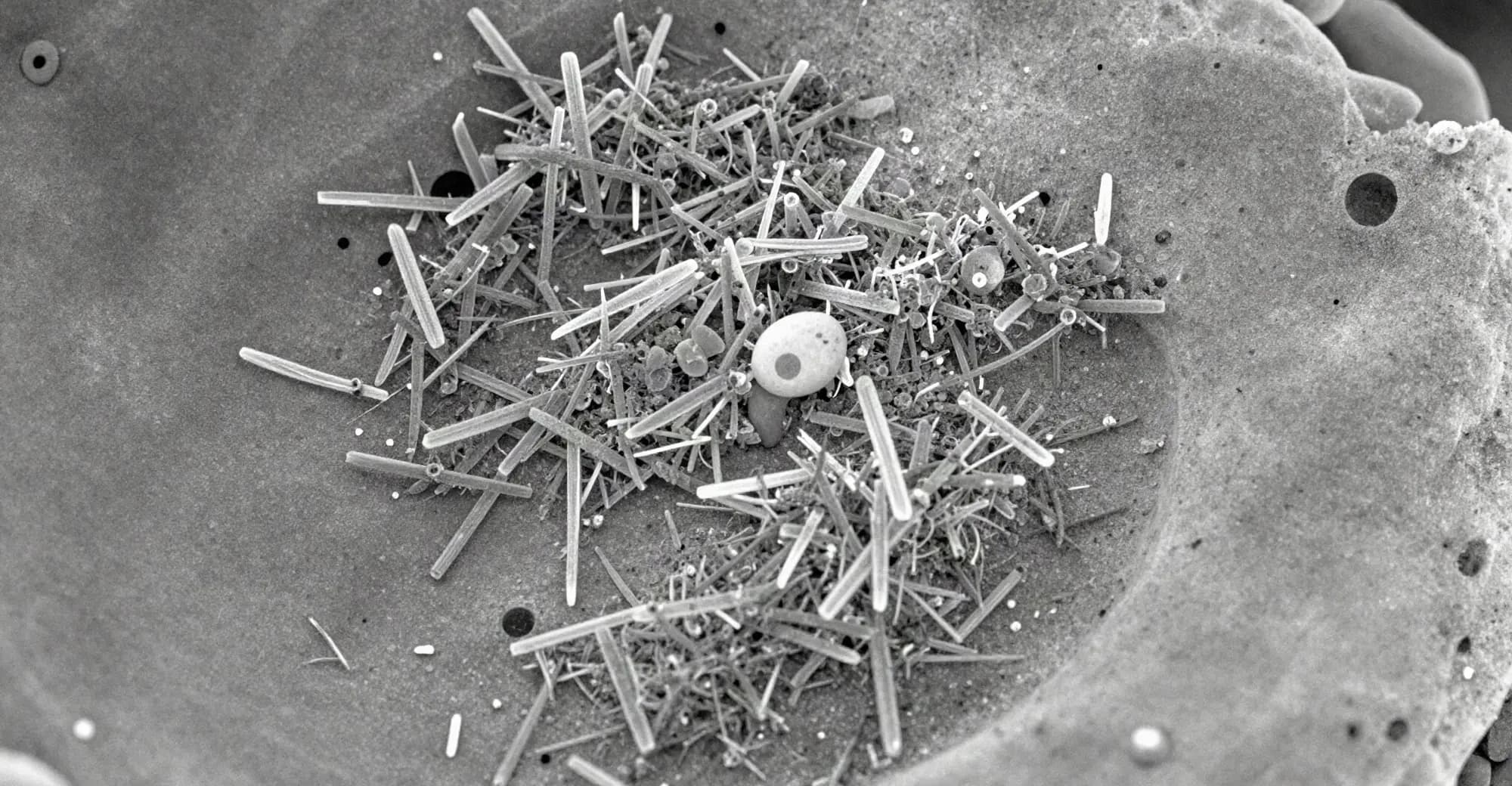 Micrografia eletrônica em tons de cinza de uma superfície cerâmica porosa recoberta por uma camada de cristais aciculares.